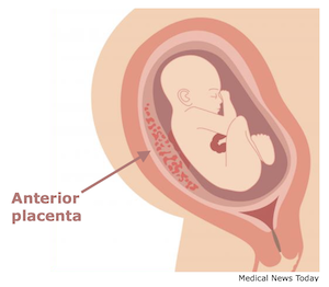 Anterior placenta small sales baby